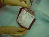 После рождения ребенка и пересечения пуповины кровь поступает в стерильный контейнер